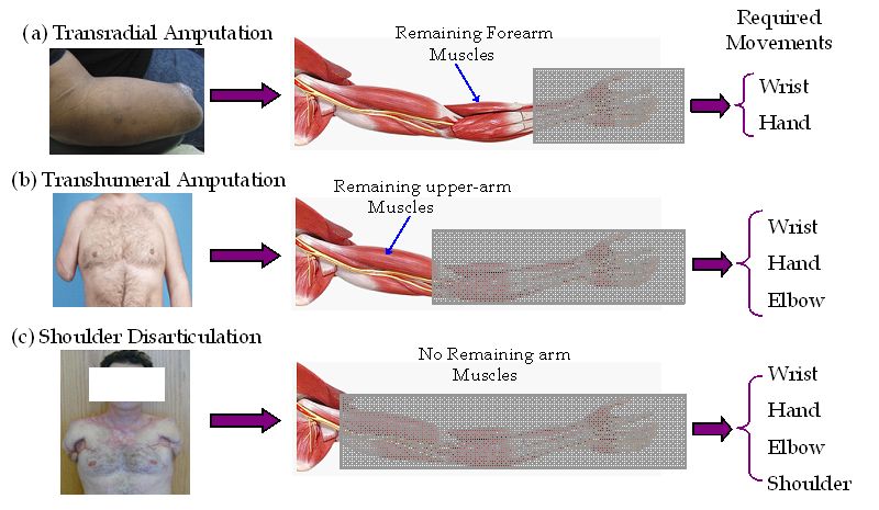 Electromyography Pattern-Recognition-Based Control of Powered ...