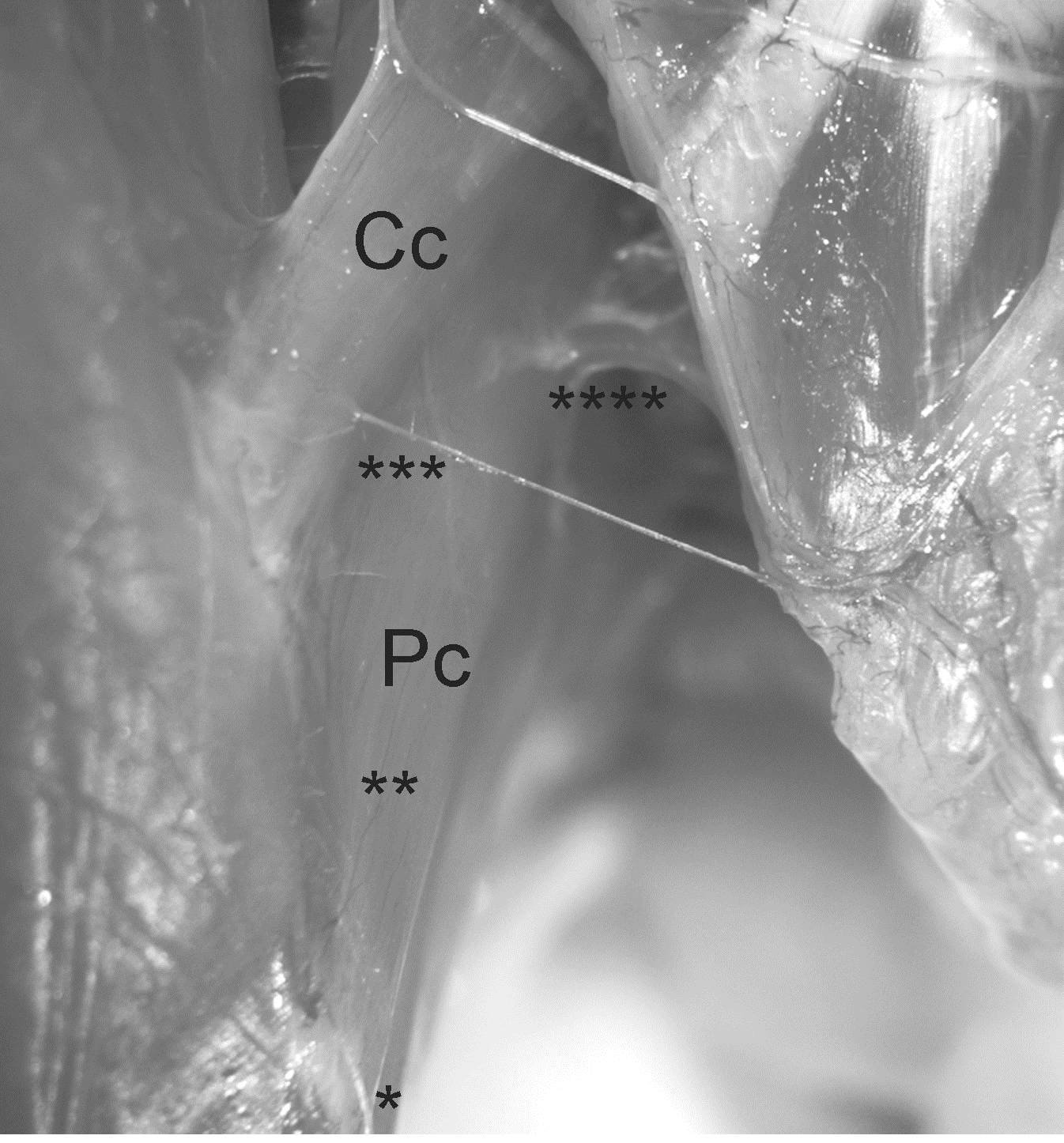 Electromyography Of Pelvic Floor Muscles In Rats Intechopen