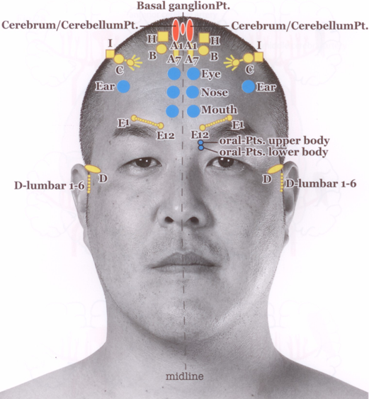 Yamamoto New Scalp Acupuncture (YNSA): Development, Principles, Safety, Effectiveness and Clinical Applications | IntechOpen