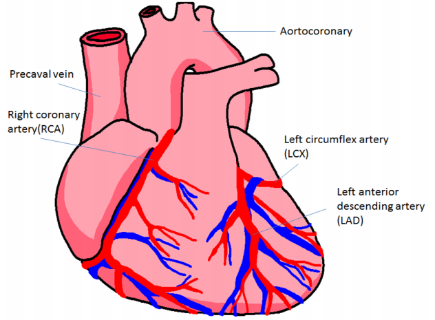 Generating Graphical Reports on Cardiac Catheterization ...