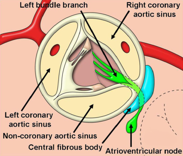 Anatomy And Function Of Normal Aortic Valvular Complex Intechopen