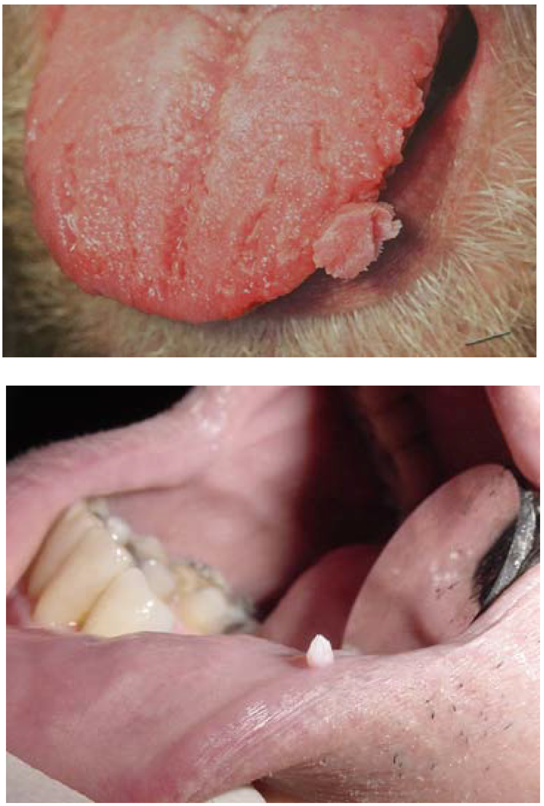 papilloma and fibroma difference