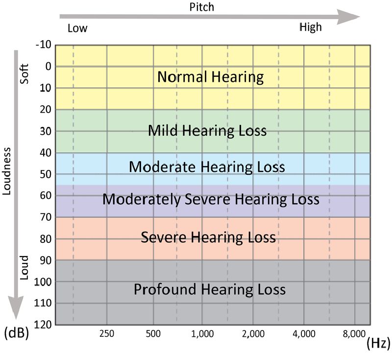 Hearing Loss Chart For Hearing Levels