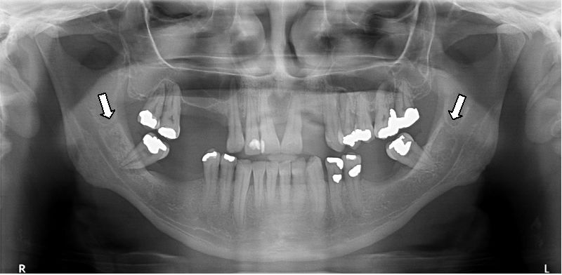 Panoramic Radiography — Diagnosis of Relevant Structures That Might