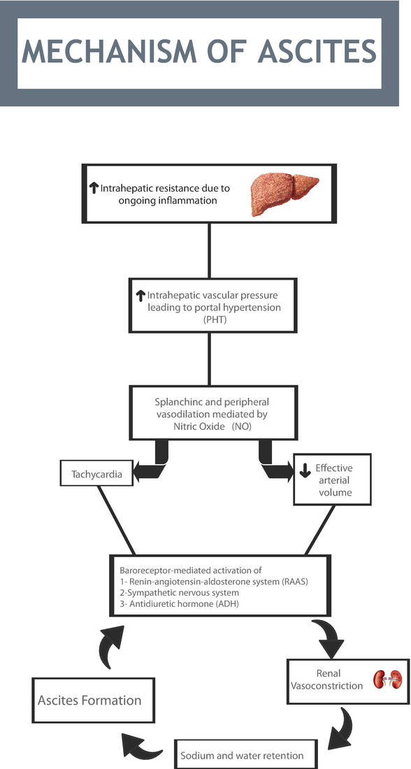 Pathophysiology Of Liver Cirrhosis In Flow Chart