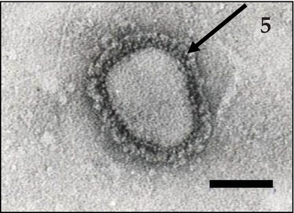Corona Virus Electron Microscope Image - Never lost your place