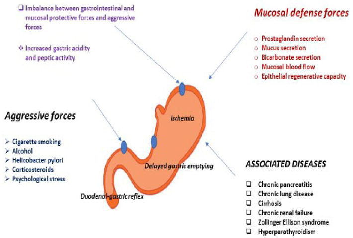 Pathophysiology Of Peptic Ulcer In Flow Chart