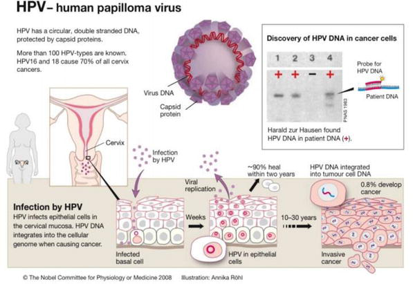Can human papilloma virus kill you - Hpv virus can it kill you Can human papillomavirus kill u