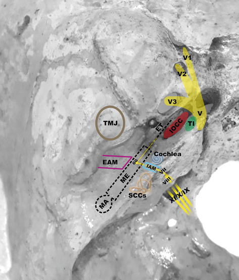 Surgical Anatomy of the Temporal Bone | IntechOpen